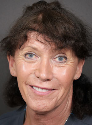 Jenny Bowman – Electrolysis Specialist