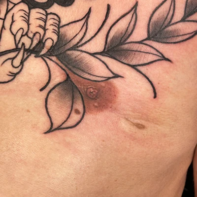 Areola Tattoo Before & After
